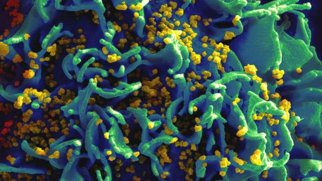 hiv_infected_t_cell